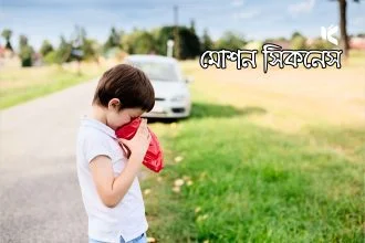 ভ্রমণে বমি-মাথা ঘোরা: কারণ, প্রতিরোধ ও সমাধান - Kuhudak